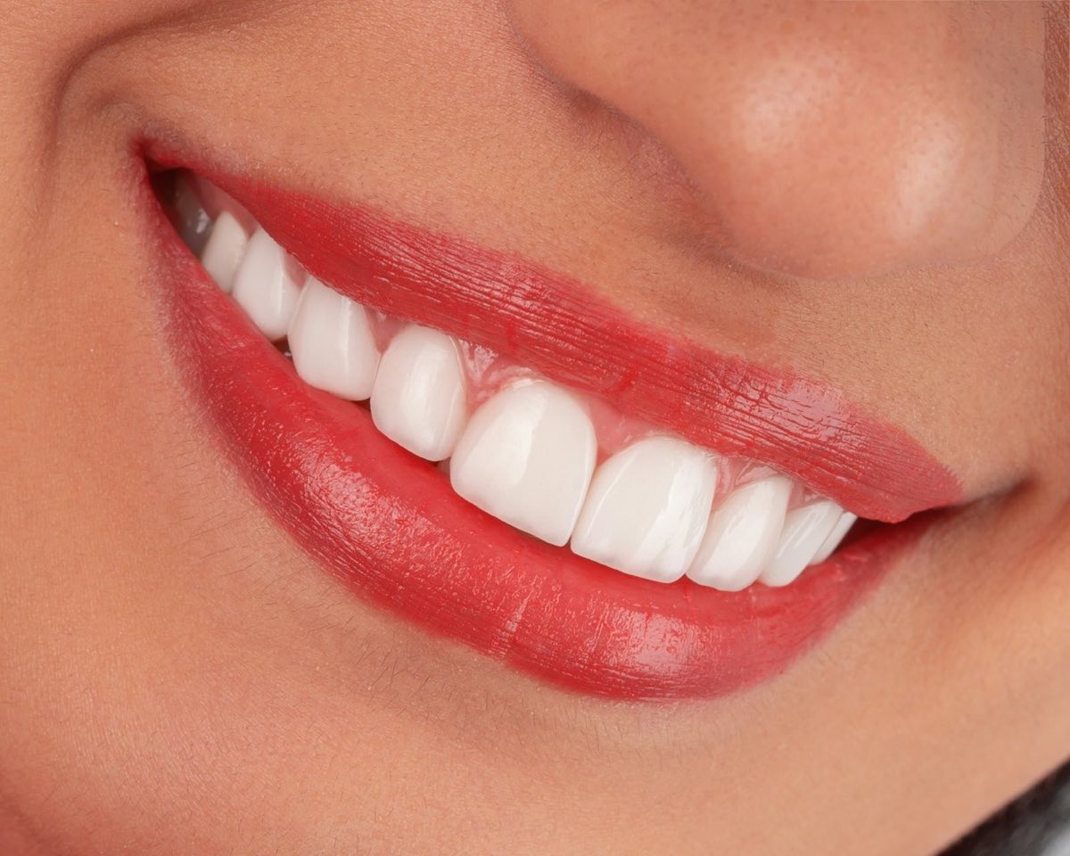 Primer plano de una sonrisa con dientes blancos y alineados